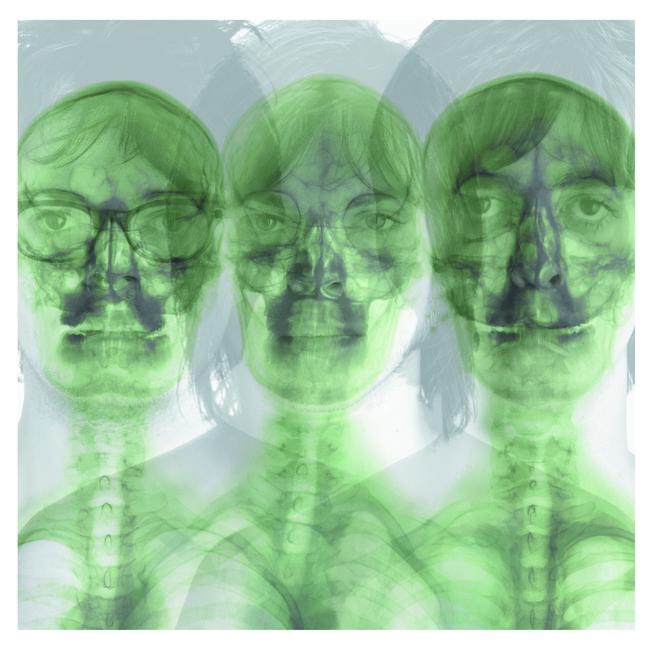 Supergrass