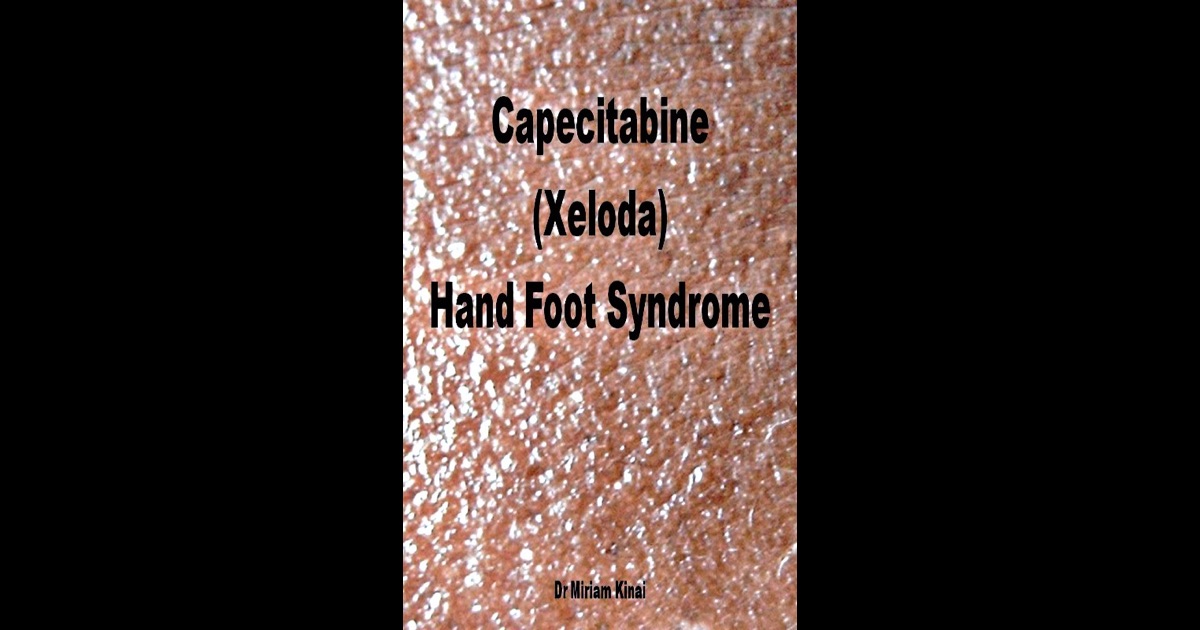 Capecitabine (Xeloda) Hand Foot Syndrome by Dr. Miriam Kinai on iBooks