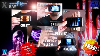Screenshots of Amazing X-Ray FX ² LITE for iPhone