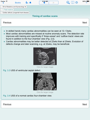 Oxford Handbook of Obstetrics and Gynaecology, Second Edition screenshot 8