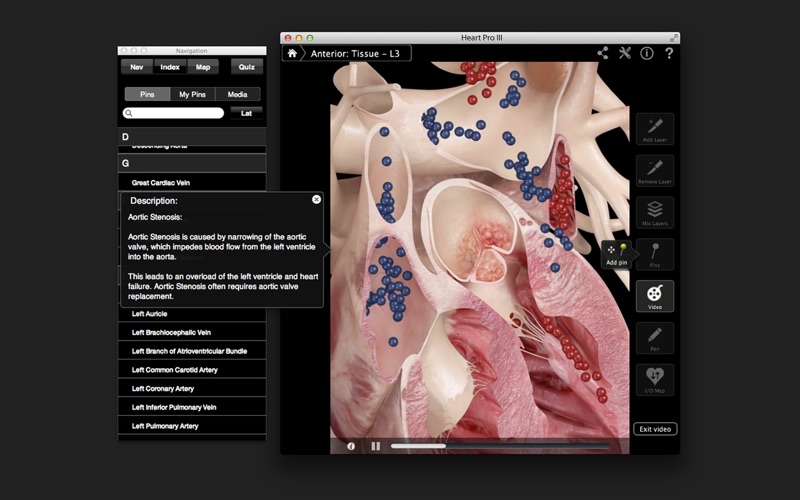 3d4medical muscle system pro iii