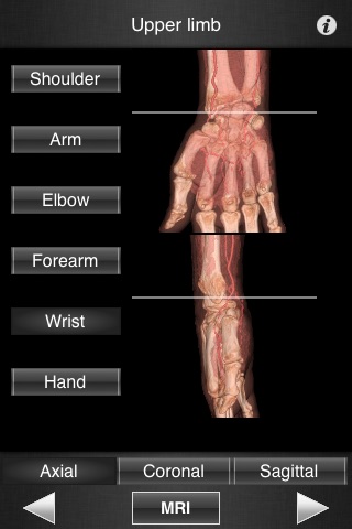 Monster Anatomy - Upper Limbのおすすめ画像1