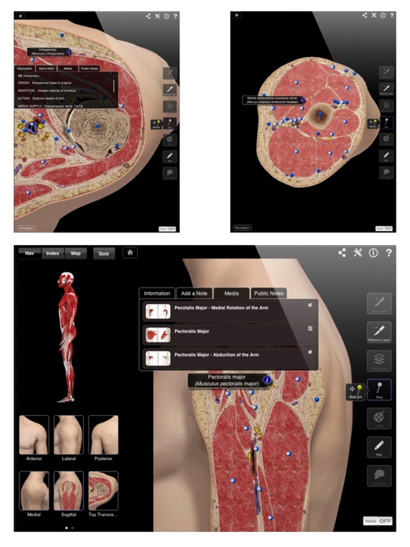 Shoulder Pro III - iPad Screenshots