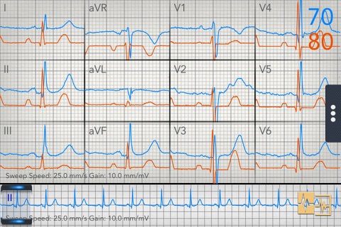 Change Healthcare ECG Mobile screenshot