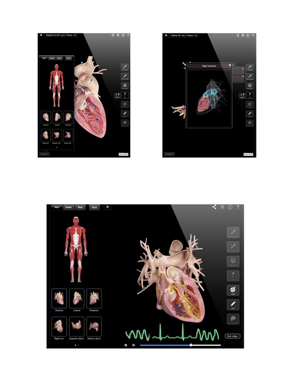 Heart Pro III Screenshots