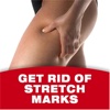 Stretch Marks 101:Essential Oils Healing,Natural Remedies and Prevention，health health beauty oils 